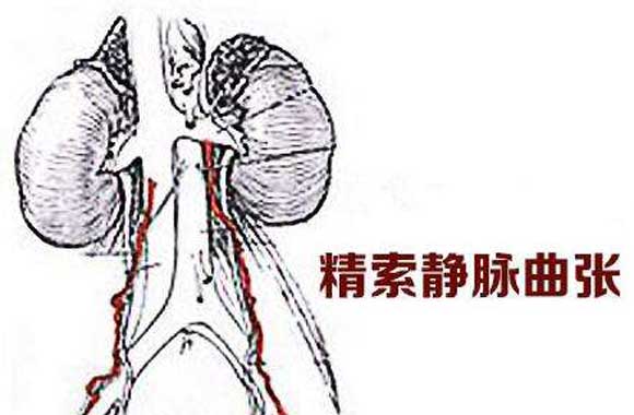 Ӱ쾫Ӳ α⾫